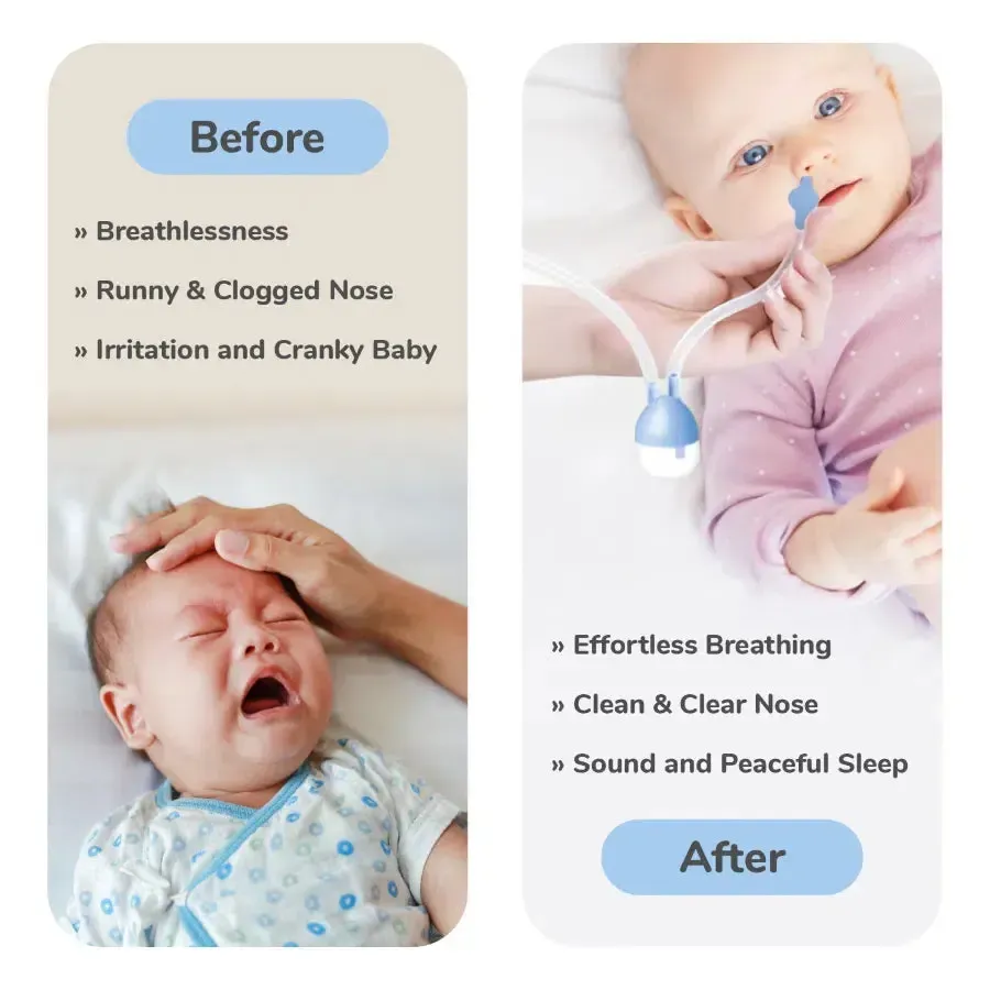 Snowy Nasal Cleaner For Baby Painless Relief from Mucus and Blocked Nose - Blue - Image 6