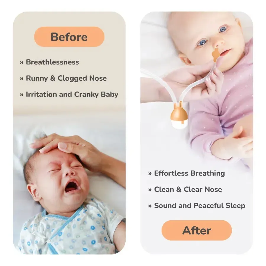 Snowy Nasal Cleaner For Baby Painless Relief from Mucus and Blocked Nose - Orange - Image 6